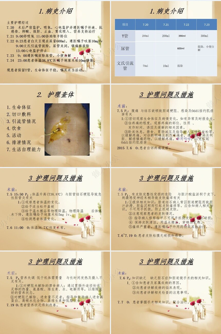 胆总管结石患者的围手术期的护理
