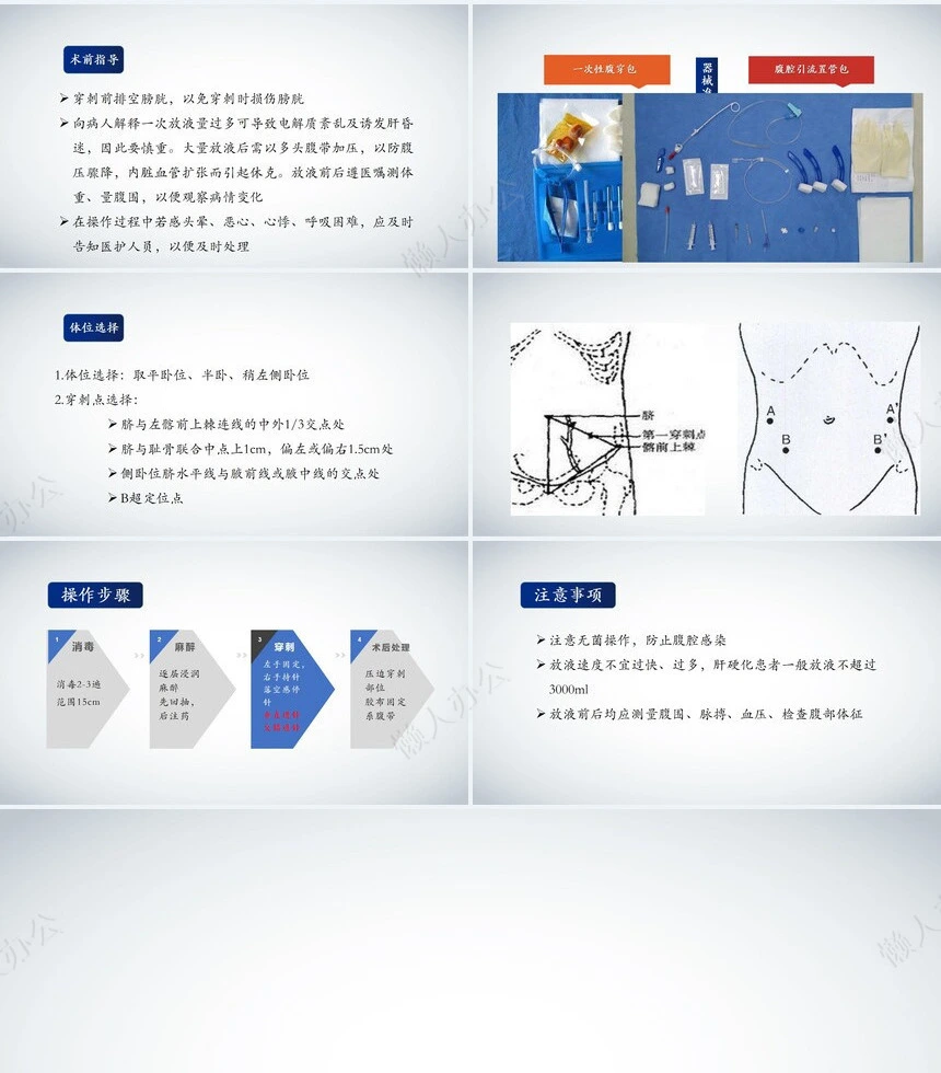 腹腔穿刺术2