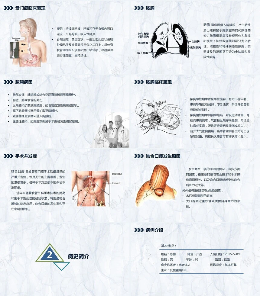 贲门癌伴脓胸吻合口瘘护理查房