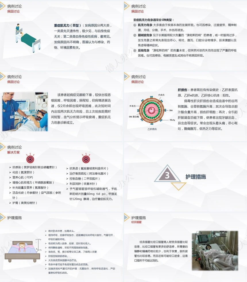 重症肌无力（Ⅲ型）护理查房